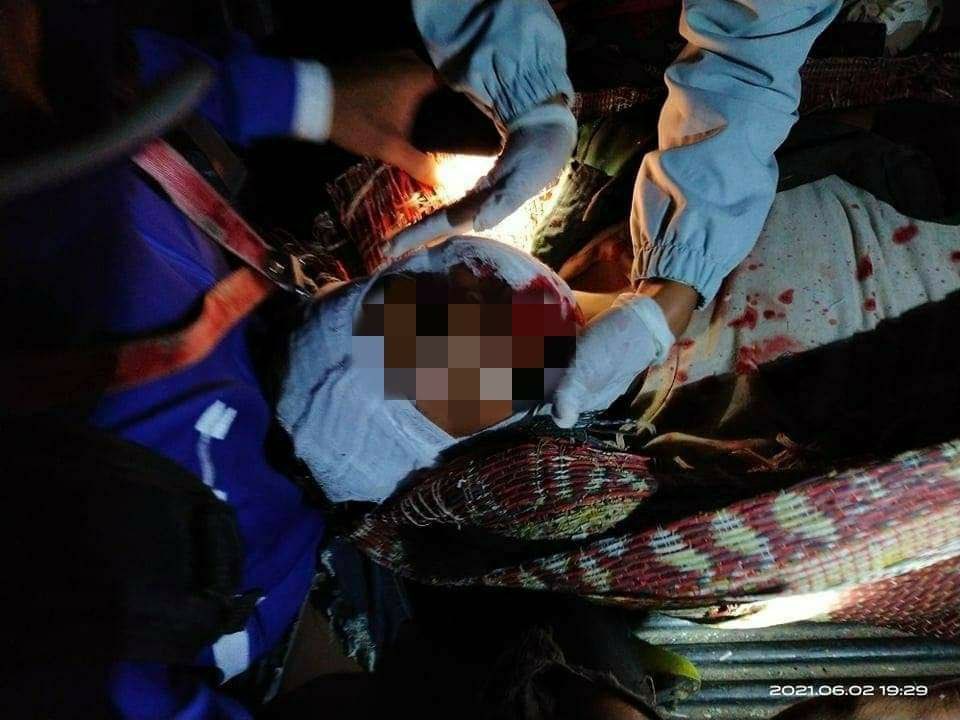 nslwin's tweet photo. MOEBYE, Shan State:

2 UNARMED CIVILIAN passers-by were shot and seriously injured by SAC Terrorist Group's sniper at 7pm on June 2. One had a bullet coming out of his mouth. Another one is still with SAC and difficult to rescue.

#June3Coup #WhatsHappeningInMyanmar https://t.co/1VDOe55E6E