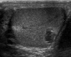 TW Pornstars - BallbustingStacy. Twitter. Oops I did it again. Splurt