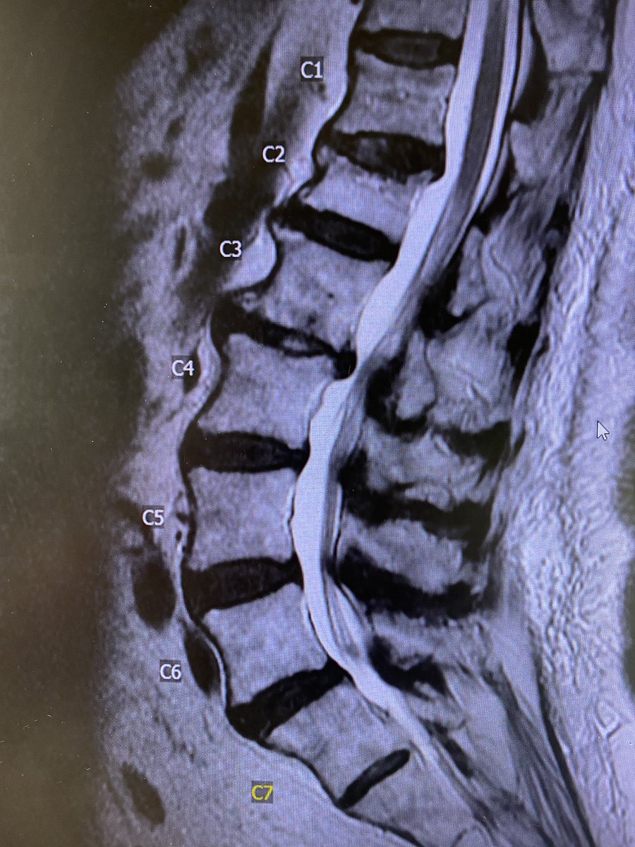 Kristen Scheitler, MD, PhD tweet media