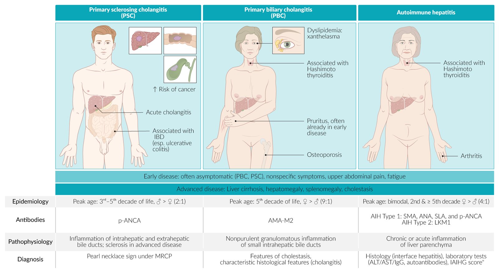 Autoimmune Liver Diseases: Perspectives from Japan: Ohira
