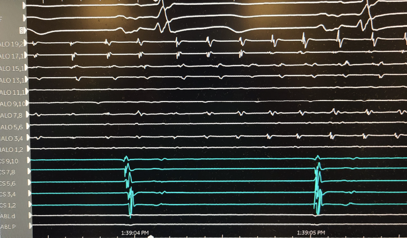 Aatish Garg tweet media