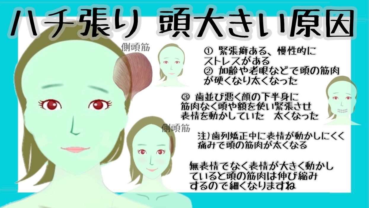 戸塚哲春の卵顔トレーニング 中目黒整体レメディオ ハチ張り 頭小さくする方法 頭 の上に筋肉があり硬くなると太く大きくなります 更に血行悪いひとは女性でも頭がとても腐くなり 抜け毛が増えます T Co Xyqu6hmfli T Co