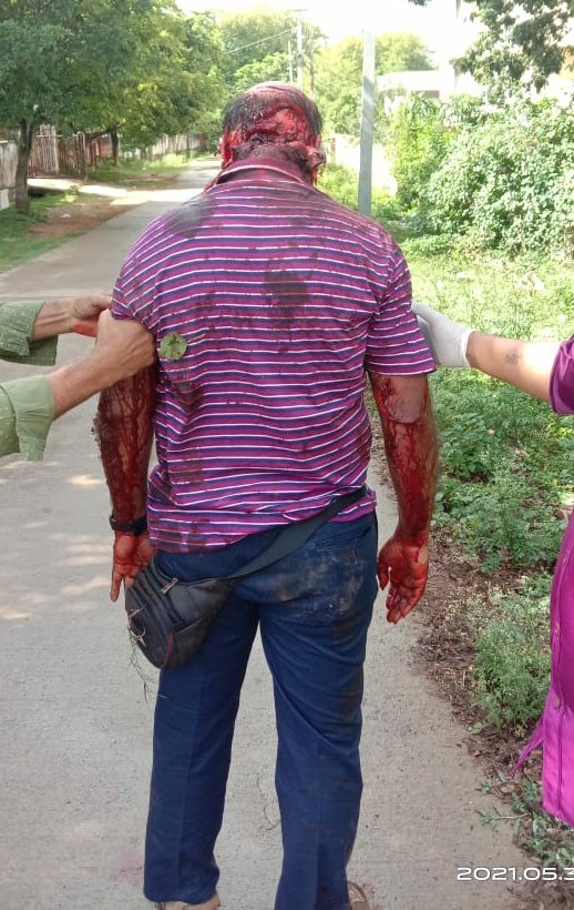 ManishK74696742's tweet photo. #StopViolenceAgainstDoctors 
Dr Deepak, Pediatrician, was Beaten brutally, inhumanly by 4 people  at Karnataka. 

CC: @CMofKarnataka @DgpKarnataka for necessary action a/g culprits

We request @AmitShah / @drharshvardhan to implement #CentralProtectionAct ASAP

@ANI https://t.co/eGCFt257cy