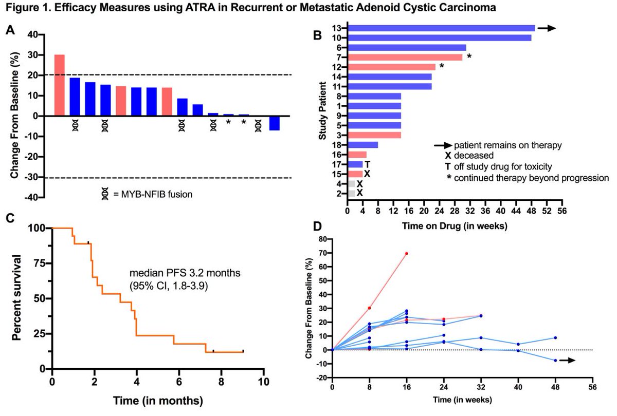 Phase II results of ATRA for #ACC now available. Some stabilizing effect in prior VEGFR treated and low MYB expressers. Waiting for ATRA+apatinib data @ASCO 🧐🔎@leonard_zon @HNOPDFCI @DF_HeadandNeck @DanaFarberNews @accrf_org @SGCancerUK @ACCResearch1 authors.elsevier.com/a/1dAmA4tFDICS…