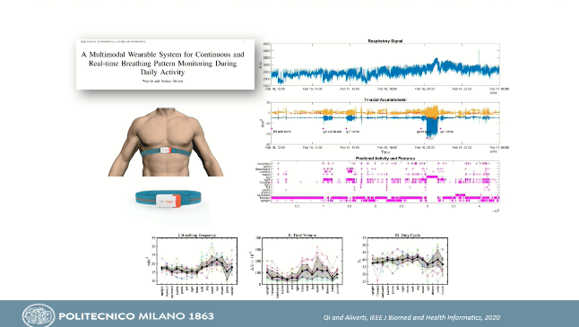 LaneFoxResearch's tweet photo. Fascinating review of wearable technology in #respiratorymedicine from Prof Andrea including:
⌚️Explosion of tech
⌚️Need for #COPD exacerbation & accessible sleep monitoring
⌚️Patient-centric models providing alerts to healthcare professionals
#ERSSummit @EuroRespSoc https://t.co/VCyPZ87UkW