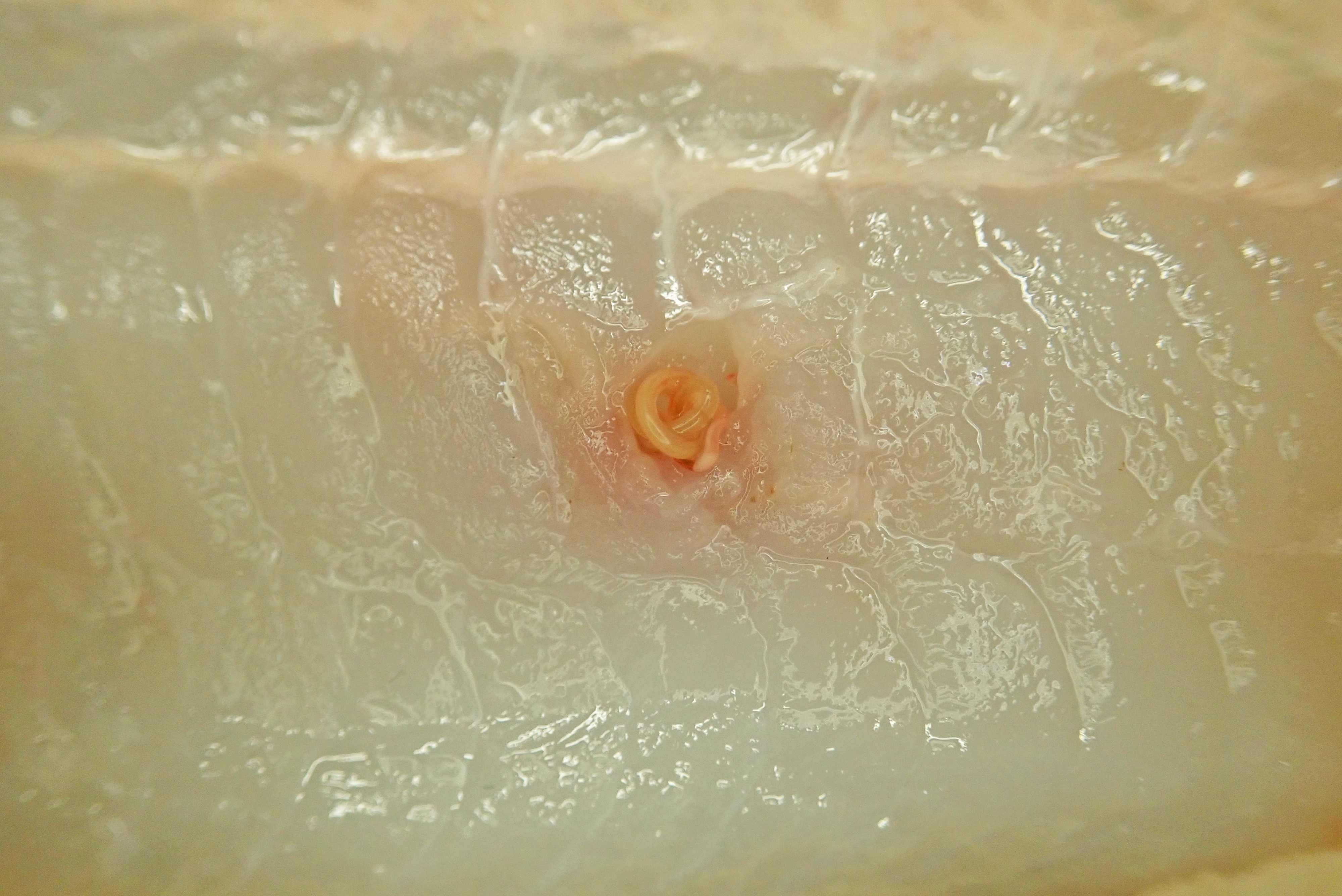 旭川医大寄生虫学講座 いろんな寄生虫を集めてふーやれやれ疲れたな 残りの部分はおいしくいただきますかね と言ってアイナメをさばいたら シュードテラノーバさんこんにちは アニサキス属と比べて病原性は弱いと言われていますがたまに症例が報告され