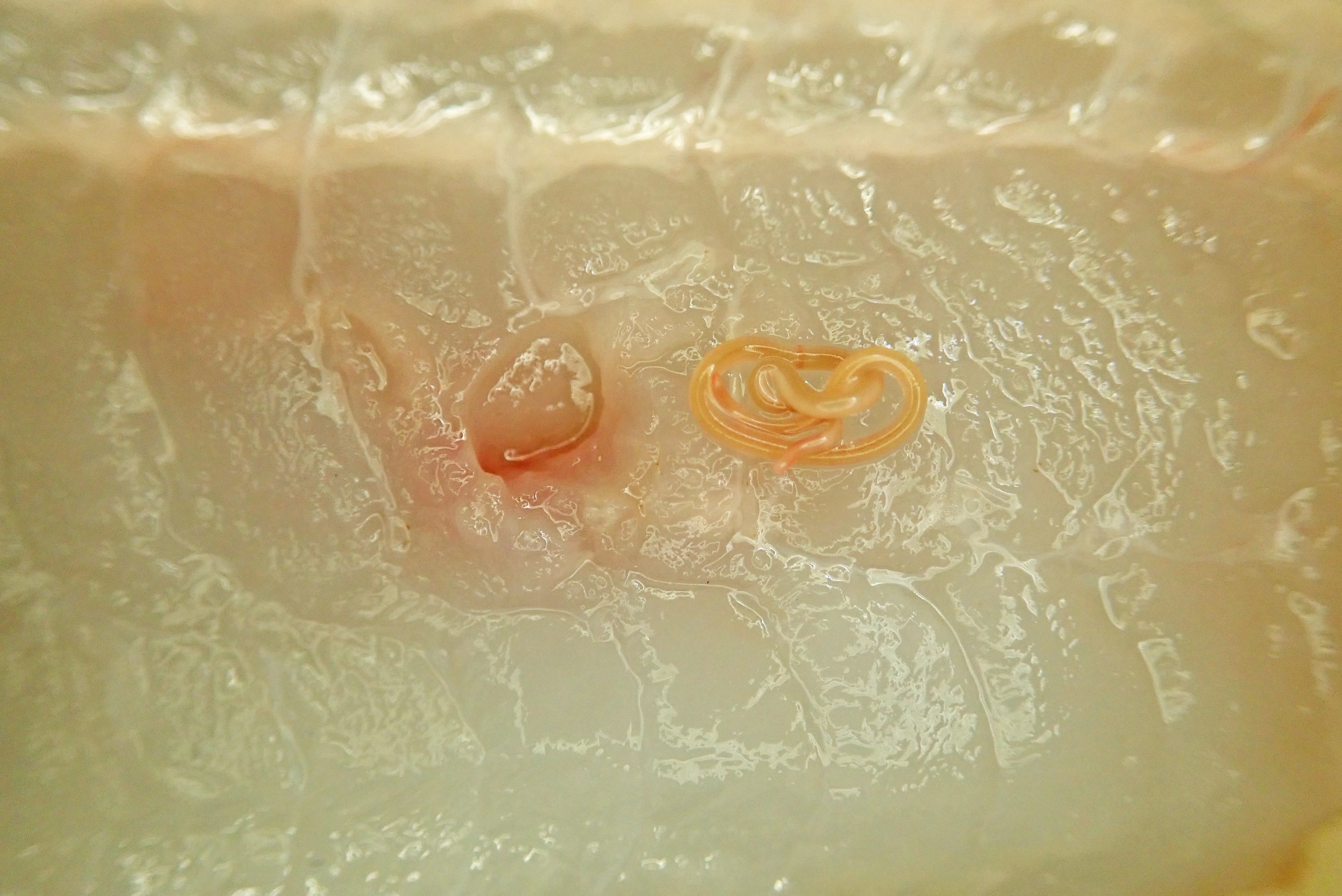تويتر 佐々木瑞希 旭川医大寄生虫 على تويتر いろんな寄生虫 を集めてふーやれやれ疲れたな 残りの部分はおいしくいただきますかね と言ってアイナメをさばいたら シュードテラノーバさんこんにちは アニサキス属と比べて病原性は弱いと言われていますがたまに症例