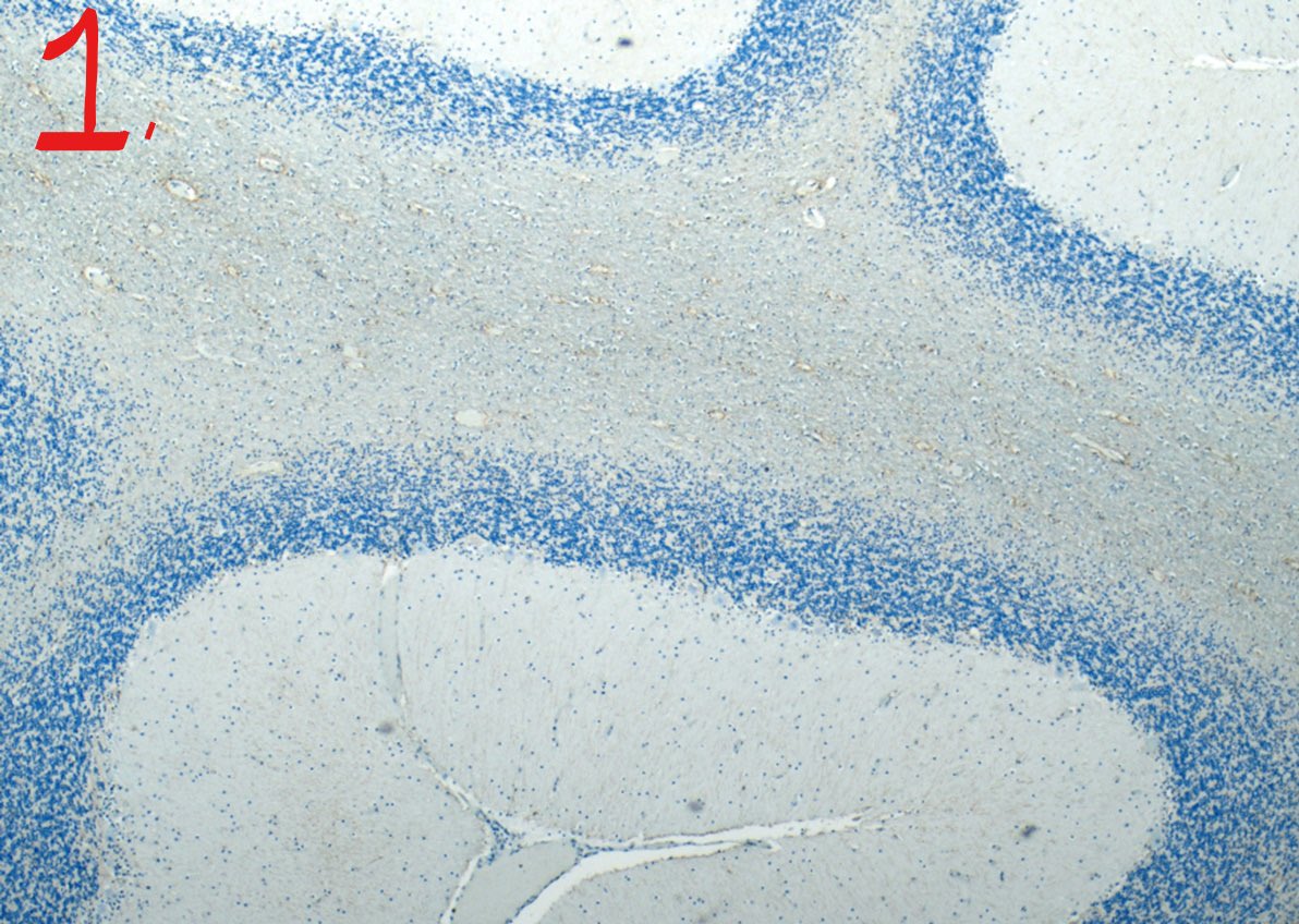 ukneqascpt's tweet photo. Seen at x4, here are two examples of glial fibre demonstration slides submitted to the Neuro Scheme🧠
Slide 1 shows a very weak demonstration and only scored 4/10. Slide 2 is an excellent example which scored 10/10!
#ukneqas #qualitymatter https://t.co/06YcUTBSkN