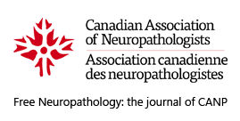 FreeNeuropatho's tweet photo. Free #Neuropathology is now the official journal of the #Canadian Association of #Neuropathologists
https://t.co/3MACvntc3X https://t.co/XFHNYtPzqV