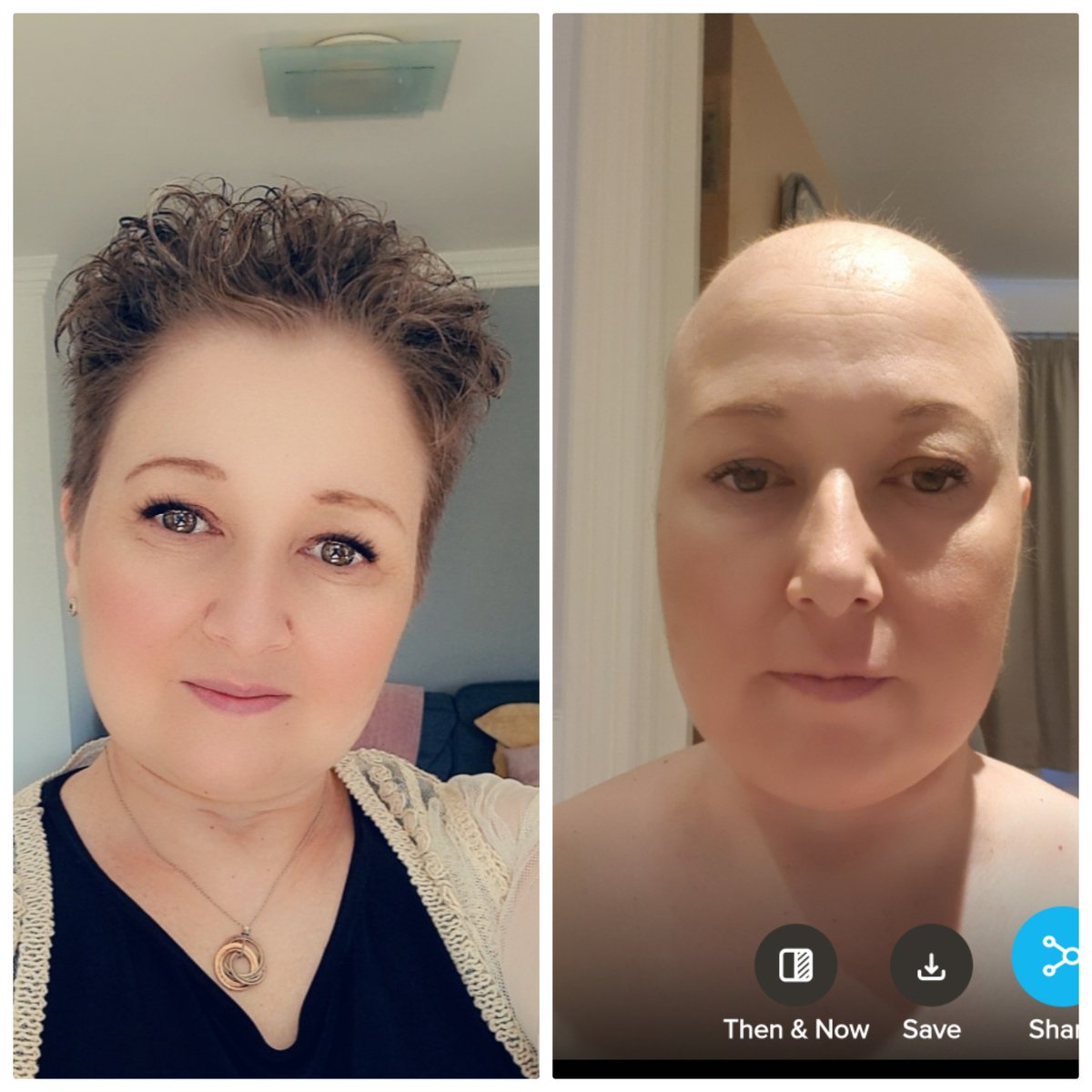 ActualMrs5ash's tweet photo. What a difference a year makes. Final dose of active treatment next week. #breastcancer #triplepositive #her2 https://t.co/suqmY2TPZy
