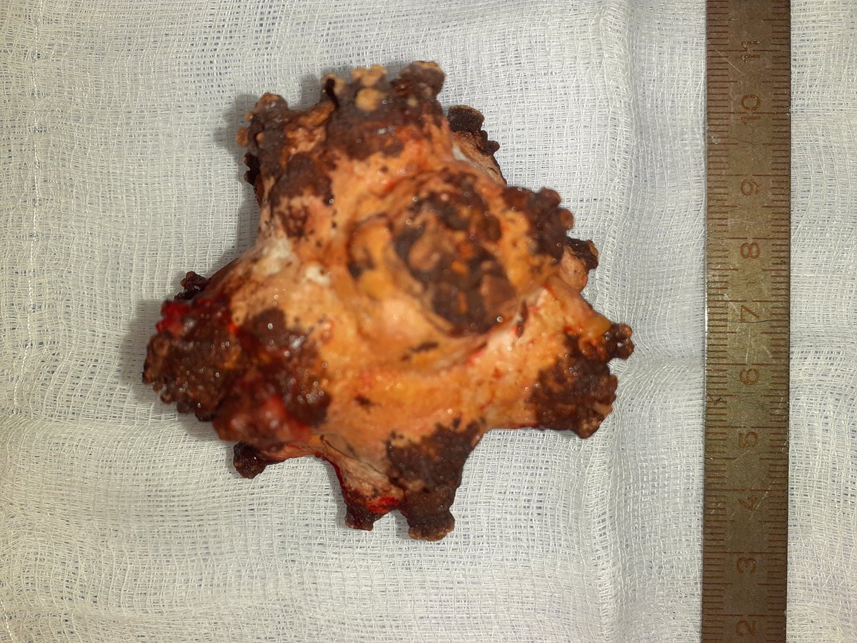 NovakKvetoslav's tweet photo. #urology,#coronavirus from the urinary bladder https://t.co/RmGrUOhAKQ