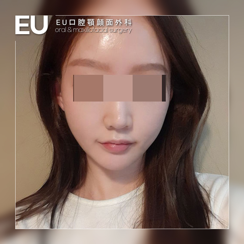 Top Tweets For 面長 Instalker