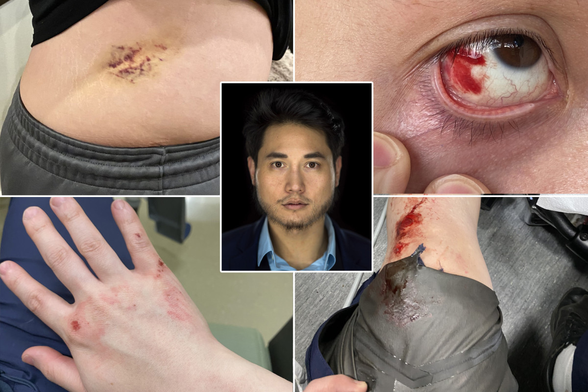 andy ngo beaten again andy ngo beaten again