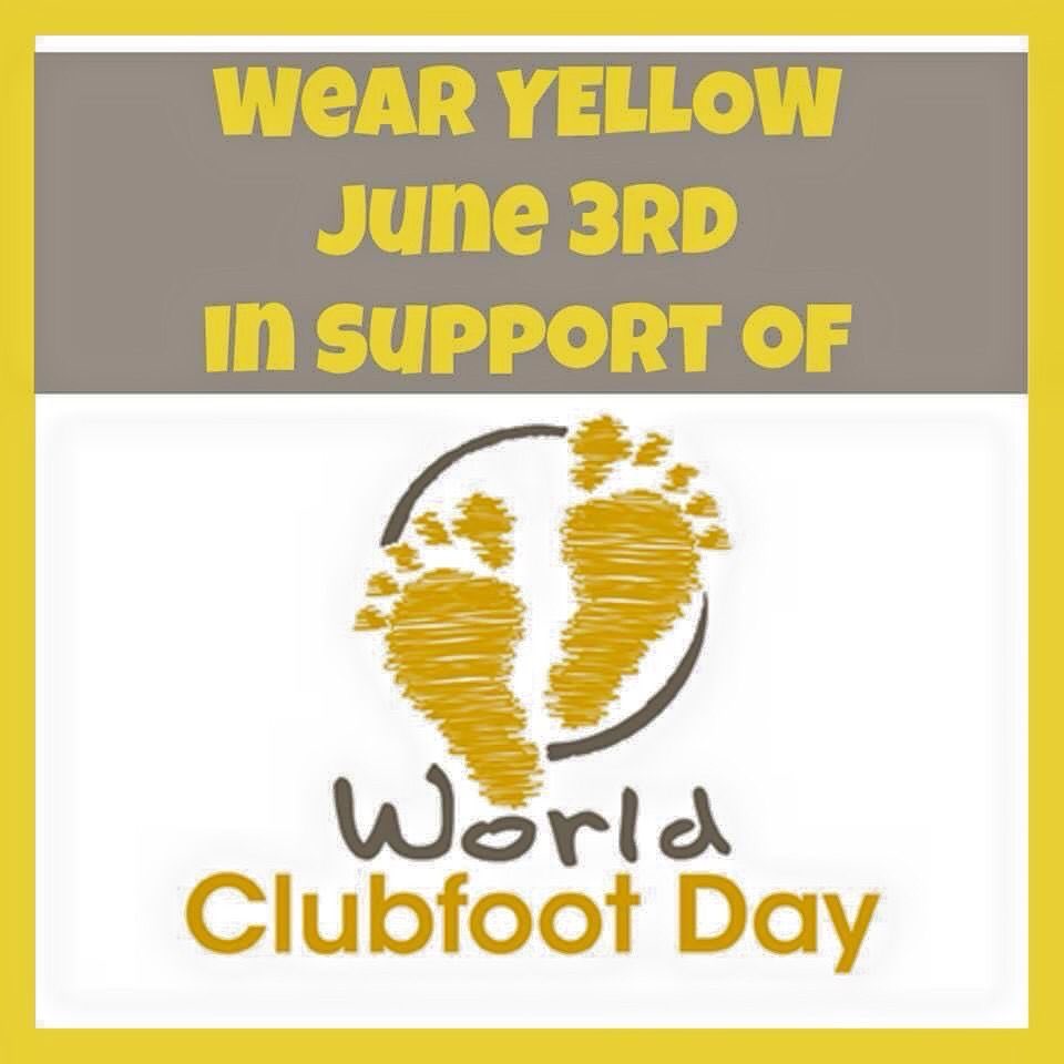 Today is World Clubfoot Day. Thinking of all ofour community members born with this condition.