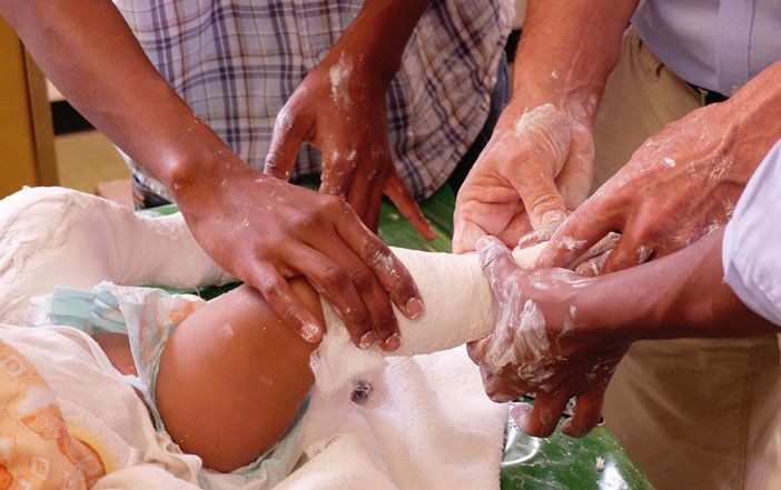 ndorms's tweet image. We are very grateful to work with many fantastic organisations, supporters and NHS volunteers to help children born with #clubfoot to walk. Find out more about our ACT project and clubfoot research here: bit.ly/34GrMt1 #WorldClubfootDay