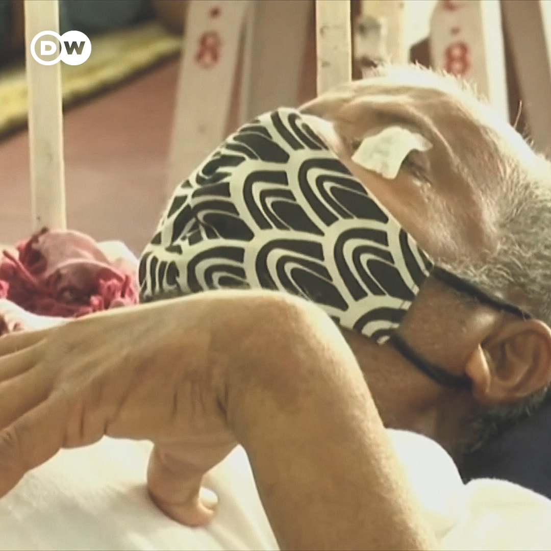 DW News on Twitter "COVIDridden India is now facing an outbreak of
