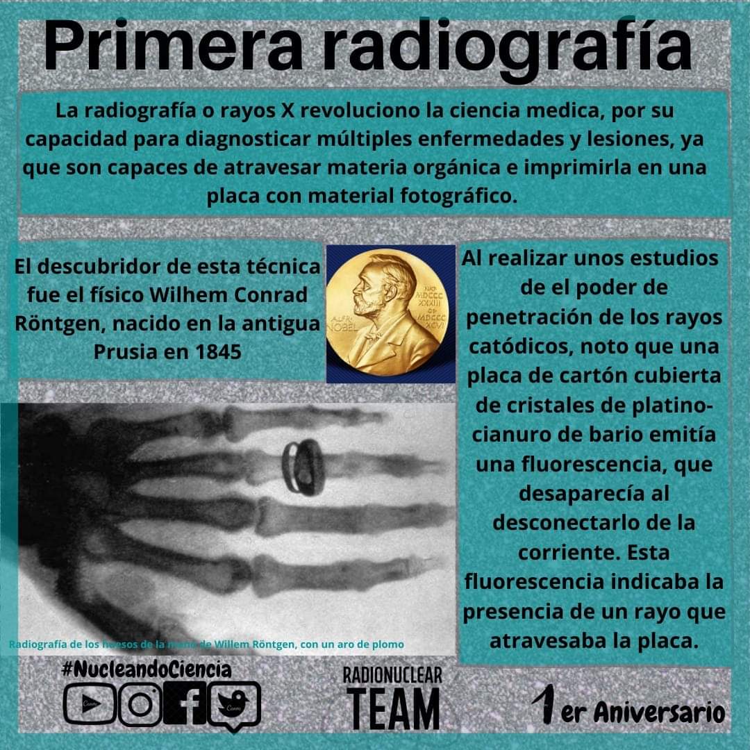 radio_nuclearT's tweet photo. Mis queridas y queridos Radio-Núcleos ☢️🖤 
En 1895 se tomó la primera radiografía, estás son las que nos ayudan cuando nos fracturamos algún hueso, gracias a este descubrimiento Wilhem ganó un #PremioNobel de #física en 1901.

#NucleandoCiencia https://t.co/oX1h6BpYmi
