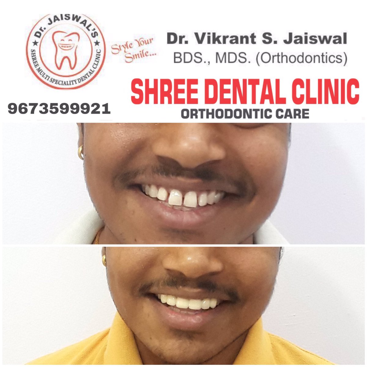 #Dentist #orthodontist #SaturdayVibes #Smile