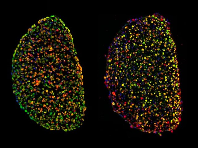 BPoD_s's tweet photo. 3D skeletal #muscle fibre bundle model for investigating muscle #disease #PompeDisease and treatments. Image and research by @TheRealJTWang et al Nenad Bursac lab @DukeU in @CommsBio. Read more on https://t.co/k93NzxA9ZX with @MRC_LMS https://t.co/cPpdihSDRD