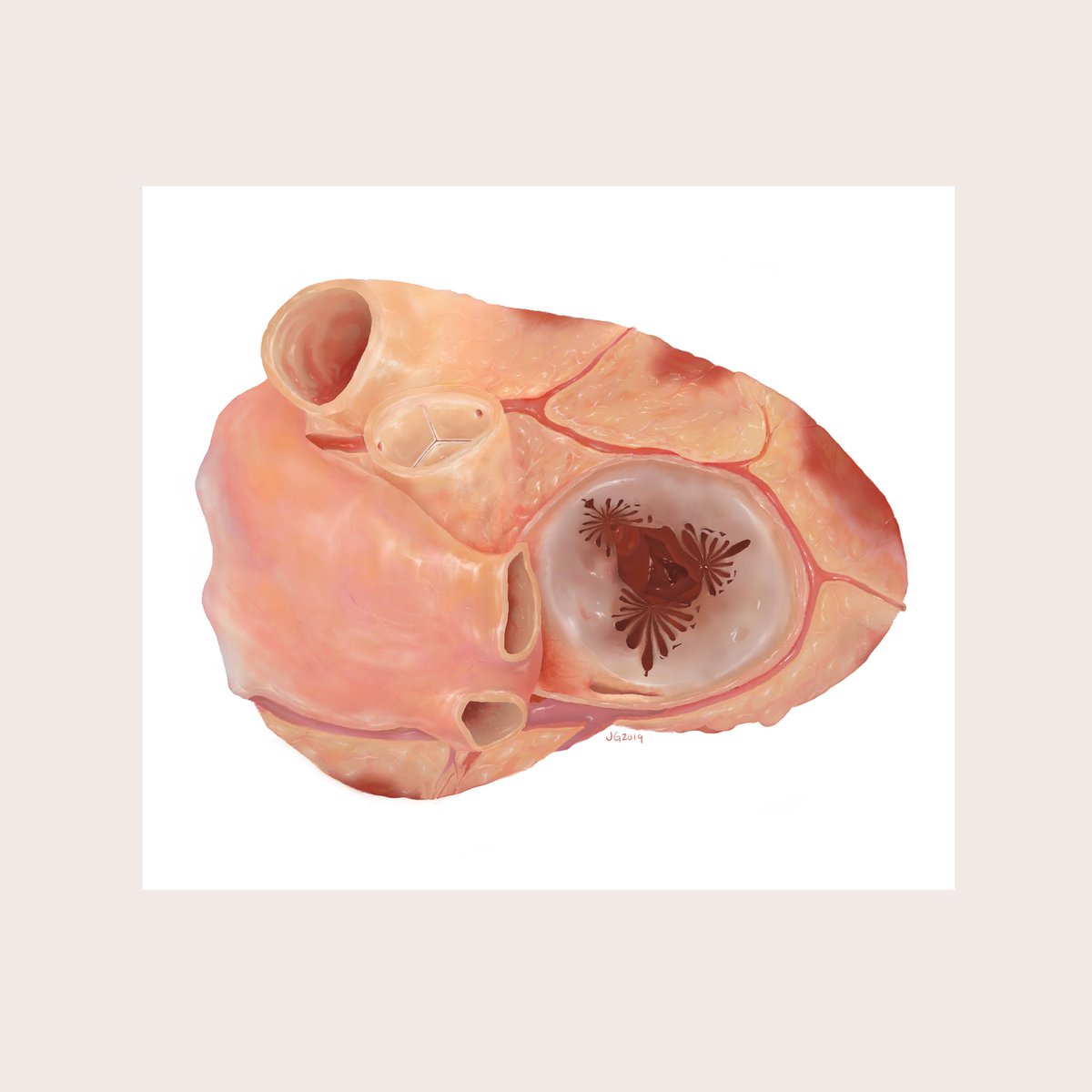 Heart | A superior view into the right ventricle | Dec. 2019 

#photoshop #illustration #medicalillustration #anatomy #medicalart #jugubiovis