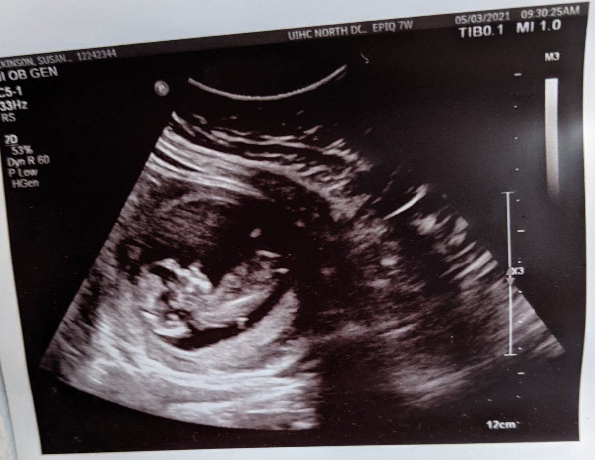 MrDclass's tweet photo. Since the word is FINALLY leaking out I feel confident sharing the news here:

All of my dad jokes are about to make a lot more sense! https://t.co/KUVujkSnen