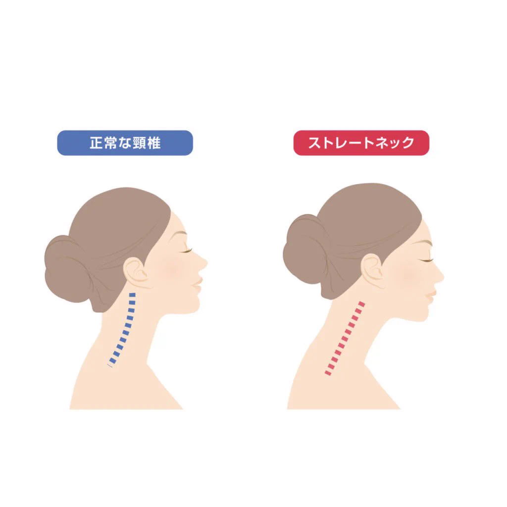首〜鎖骨を綺麗に見せたい方は必見！胸鎖乳突筋ストレッチ！