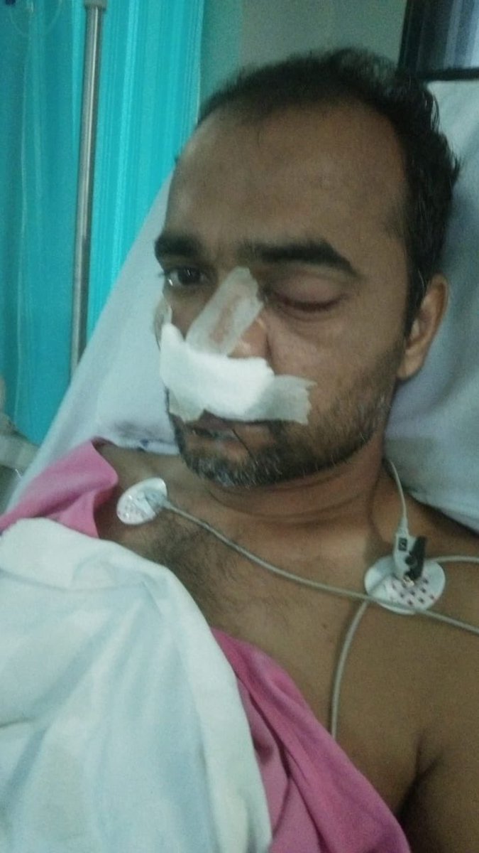 SwapnaR68424804's tweet photo. Dear sir/mam @KTRTRS @KTRoffice @RaoKavitha @DMETELANGANA my husband is suffering from Black fungus.He lost left eye &amp; he may loose right eye also.Infection is there in neurons and its spreading in brain.He needs #LiposomalAmphotericin 12vialsperday.Please save him and save us. https://t.co/xt1f2eT7oV