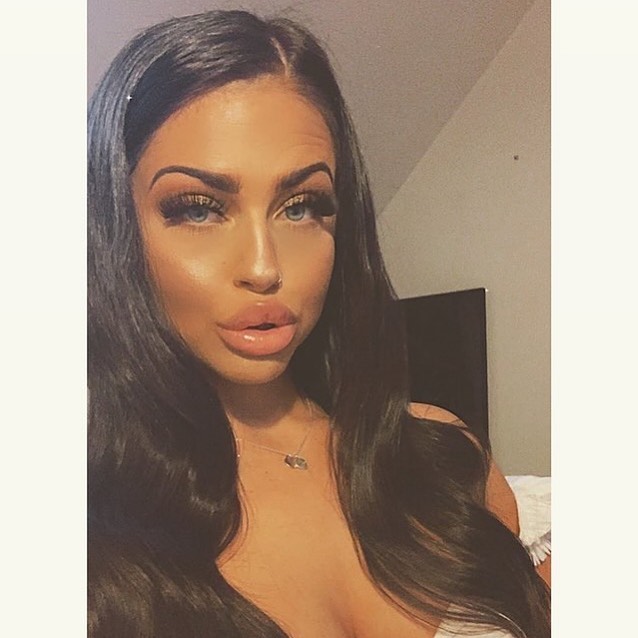 Lipaddictz's tweet photo. ashleighcoolingg Omg look at those lips! ππ #fake #lips #lipinjections #plastic #swollen #lipgap #juvederm #filler #addict #lipfetish #plasticsurgery #plasticpositive https://t.co/wPGhovKGok