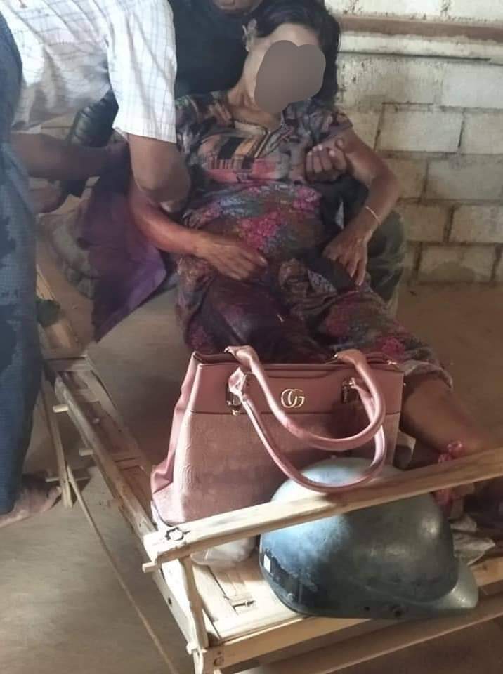 KhaingSt's tweet photo. A woman was shot in the right arm by a military council in Kayan,Thar Yar Htee Yee village today at 12:40 pm.
tw // blood
#WhatsHappeninglnMyanmar
#May23Coup https://t.co/ri1Ga0s56E
