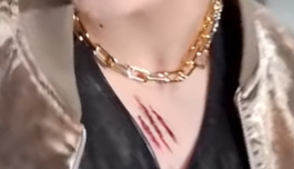 atzrewind's tweet photo. cw// fake wound

black cat nero hongjoong details https://t.co/52qutCQsT7
