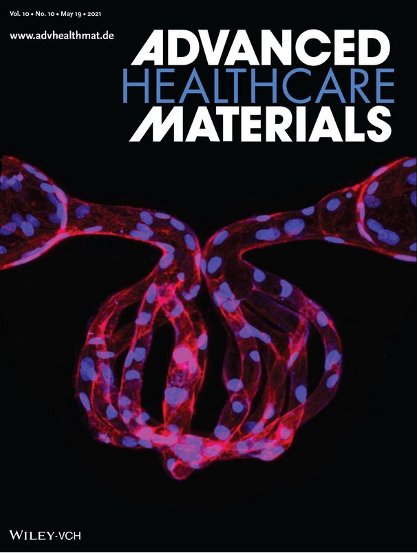 Advanced Portfolio News (@advportfolio) on Twitter photo Combining multiphoton ablation with laser-guided angiogenesis, Ying Zeng and co-workers successfully vascularize a 3D artificial glomerulus, shown here on this stunning cover!
<a href="/YingZhe47280253/">Ying Zheng</a> <a href="/UWBioE/">UW Bioengineering</a> <a href="/uwnews/">UW News</a>
Read the paper: ow.ly/gVSS50ES2V8 Combining multiphoton ablation with laser-guided angiogenesis, Ying Zeng and co-workers successfully vascularize a 3D artificial glomerulus, shown here on this stunning cover!
<a href="/YingZhe47280253/">Ying Zheng</a> <a href="/UWBioE/">UW Bioengineering</a> <a href="/uwnews/">UW News</a>
Read the paper: ow.ly/gVSS50ES2V8