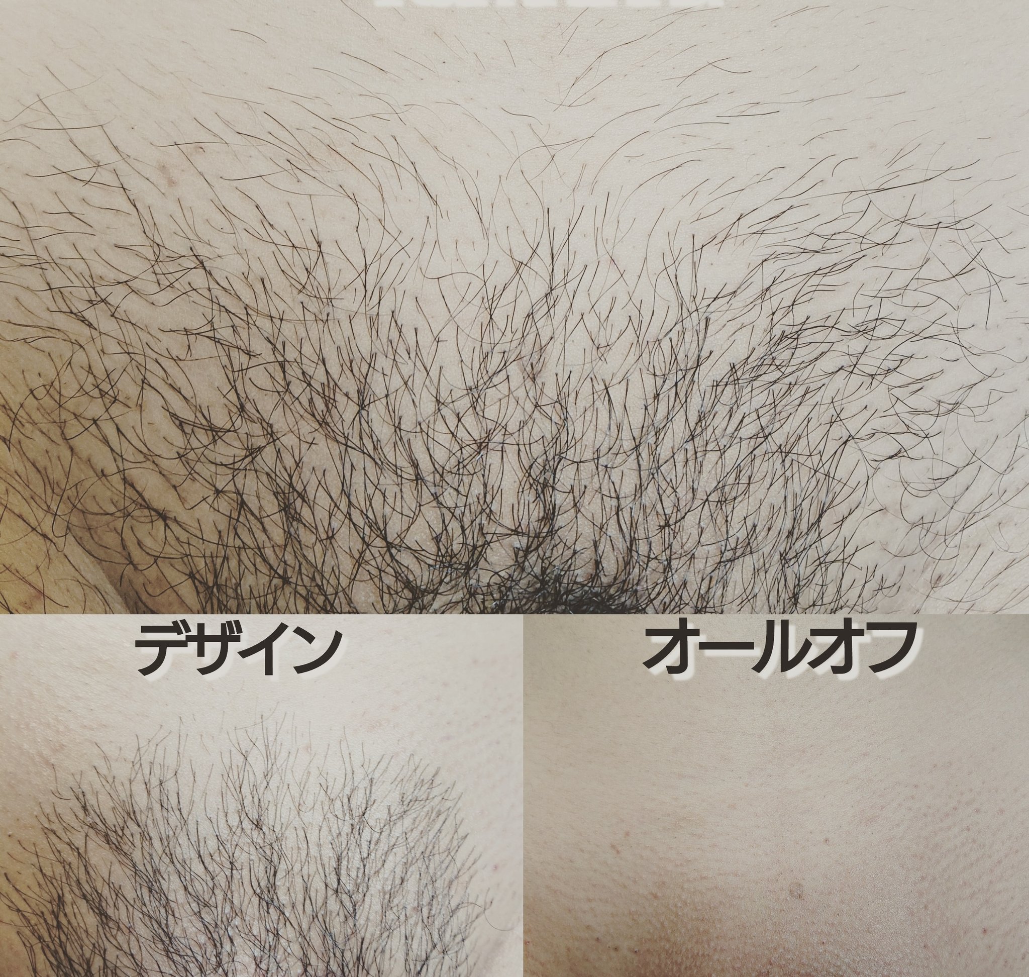 ラムヒンナー 脱毛 リラクゼーション على تويتر お風呂で脇毛やアンダーヘアを手でむしってないですか それでは排水溝が詰まってしまいます ワックス脱毛でキレイに処理しましょう 四ッ谷 曙橋 ブラジリアンワックス 蒸れ 痒み 臭い アンダーヘア