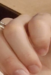 นิ้วก้อยน้อง น้องหมีน้ำ ᅲᅳᅳᅳᅳᅳᅳᅳᅳᅳᅳᅳᅳᅳᅲᅲᅲᅲᅲᅲᅲᅲᅲᅲᅲᅲᅲᅲᅲᅲᅲᅲ แง ใจแม่ 💔💔💔💔💔💔