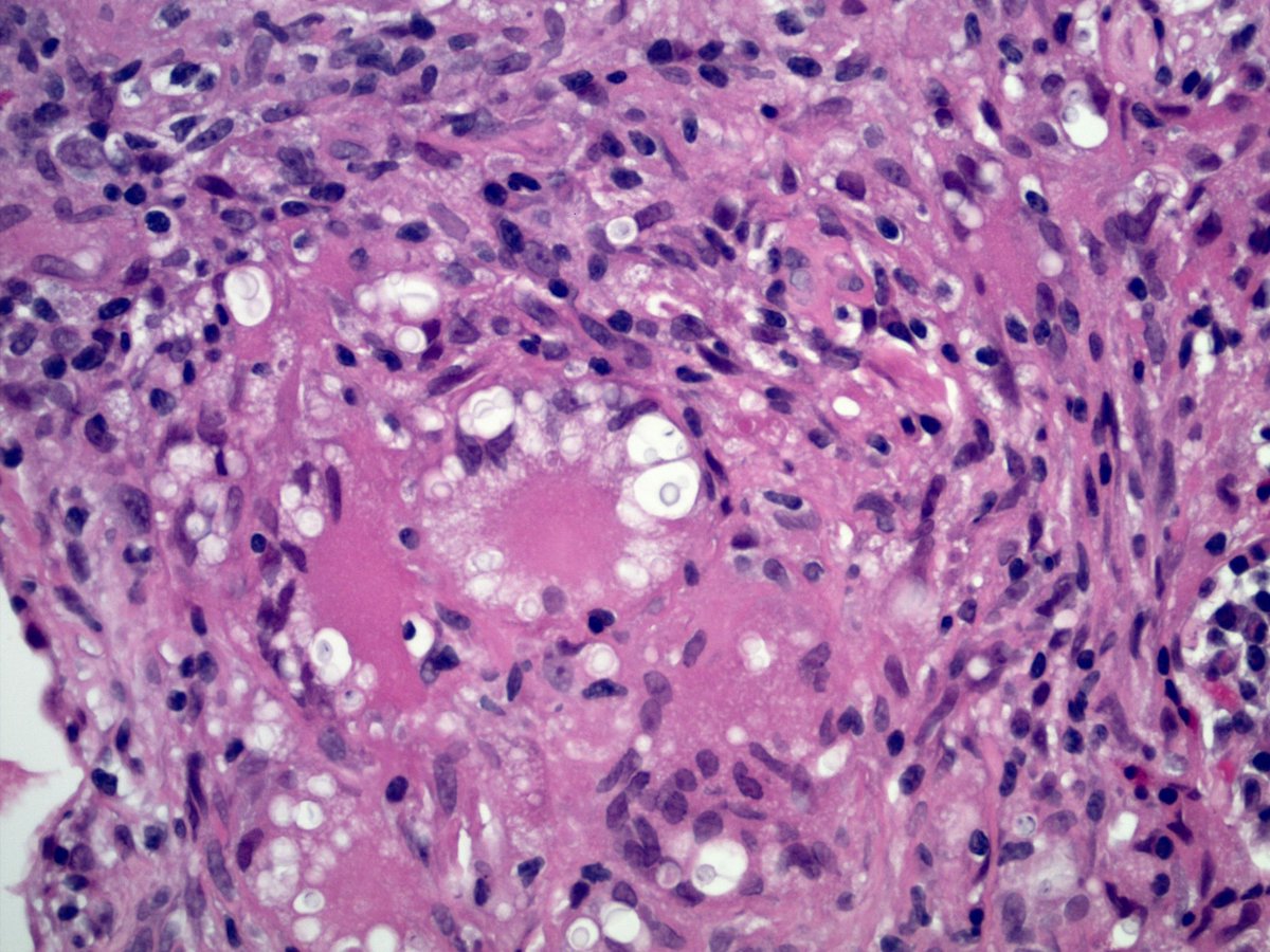 Can you name all 3? 

#Pathbugs #crittersontwitter #pathology #pulmpath #pathboards #knoworfail