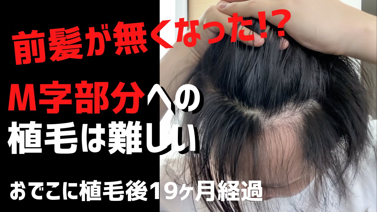 おでこを狭くする Twitter Search Twitter