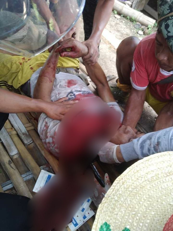 LOIKAW, Karenni (Kayah) State:

U Nyo, 41, from Warikawkhu, Kone Thar village, was wounded by bullet hit by Terrorists (Myanmar security forces).

#May23Coup #WhatsHappeningInMyanmar #MilkTeaAlliance