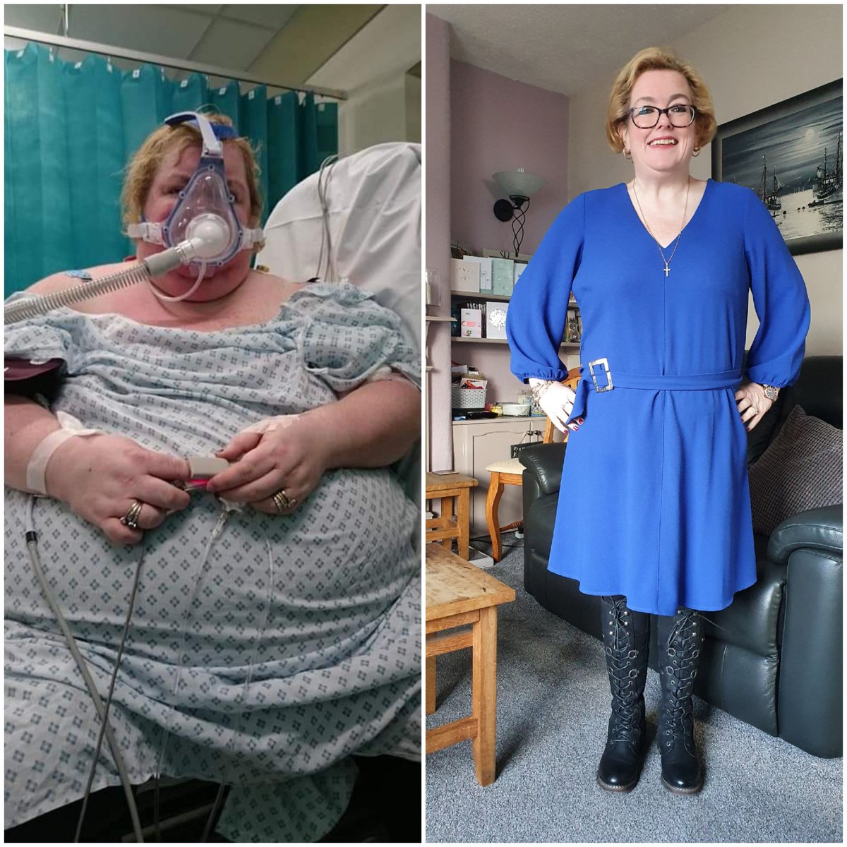 conway_michelle's tweet photo. @antmiddleton 26.7 stone to 13.2....so ill and at deaths door, to no diabetes, no sleep apnea, no high blood pressure, and so much happier in so many ways xxx https://t.co/cpR2AXAPXK