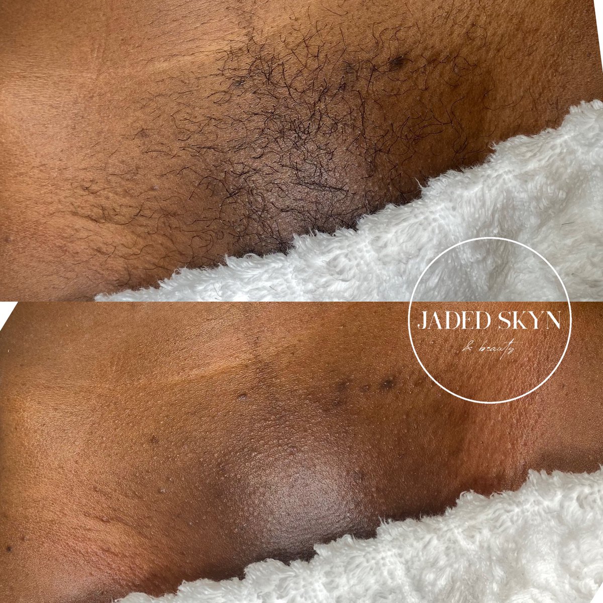 hayleytheesthi's tweet photo. Brazilian waxes are my specialty 🤌🏻

#phillyesthetician #phillyskincare #phillywaxing #phillyfacials https://t.co/CySX4Kc492