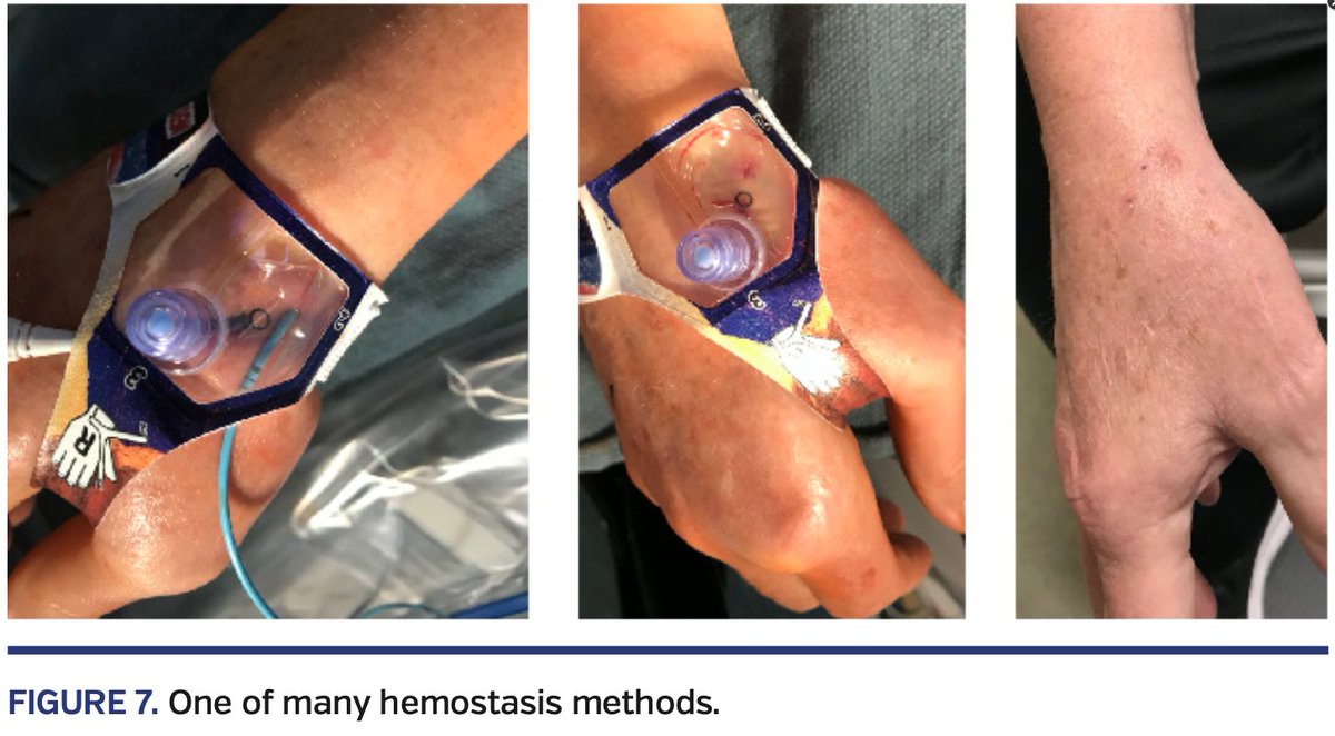 HadyLichaaMD's tweet photo. #RHC right from the #AnatomicalSnuffbox
@evhaddad @ekgpdx @duanepinto @KevinShahMD @kevinjamescroce @Allison_Dupont @mirvatalasnag @aayshacader @DougDrachmanMD @AnkurKalraMD @BaoGTran @FadiSaab17 @DrSethdb @TTelila @BaylorCardio @NavinKapur4 @Obisht @LucySafi
#Cardiotwitter https://t.co/6YvFvQjTl0