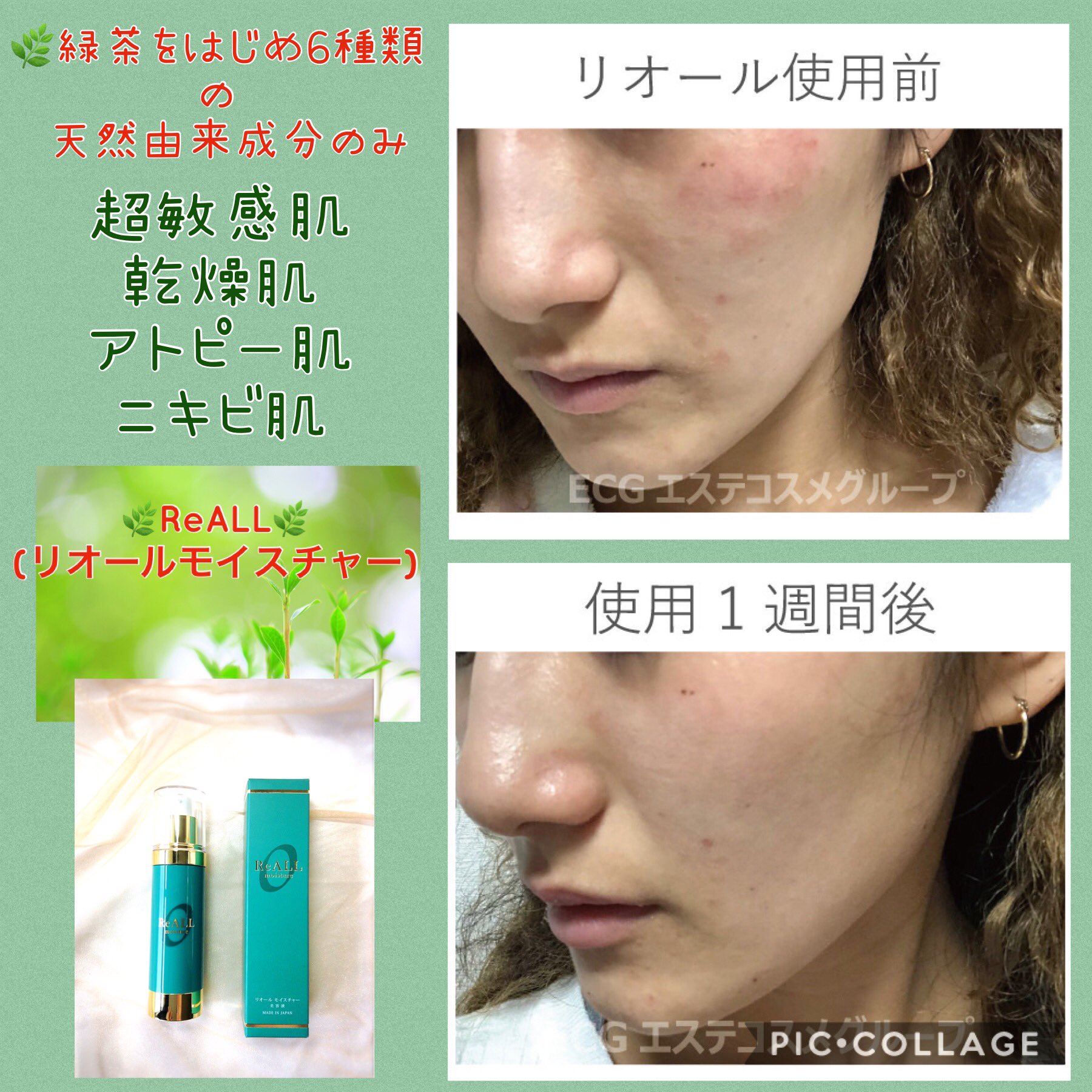 アトピー 敏感肌 美容液 リオールモイスチャー 200ml 大容量 業務用