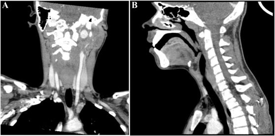 Otolaryngology Cases tweet media