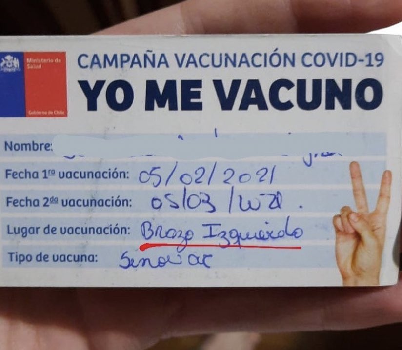 BRAZO IZQUIERDO QHSJJDJSJSKSLSSÑALSKDKD