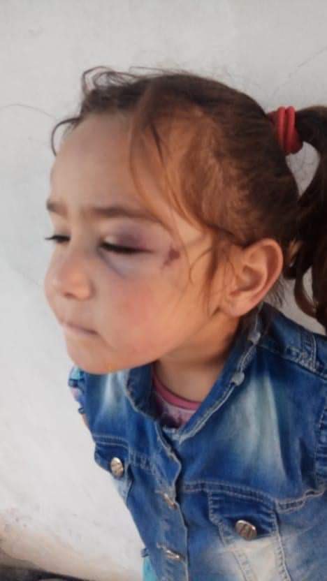 PalinfoAr's tweet photo. #صورة .. قوات الاحتلال تعتدي على الطفلة ديما محمد ربعي خلال تنفيذها حملة مداهمة وتفتيش في #الخليل بالضفة الغربية المحتلة .
#انقذوا_حي_الشيخ_جراح https://t.co/uLPgfRWZEu