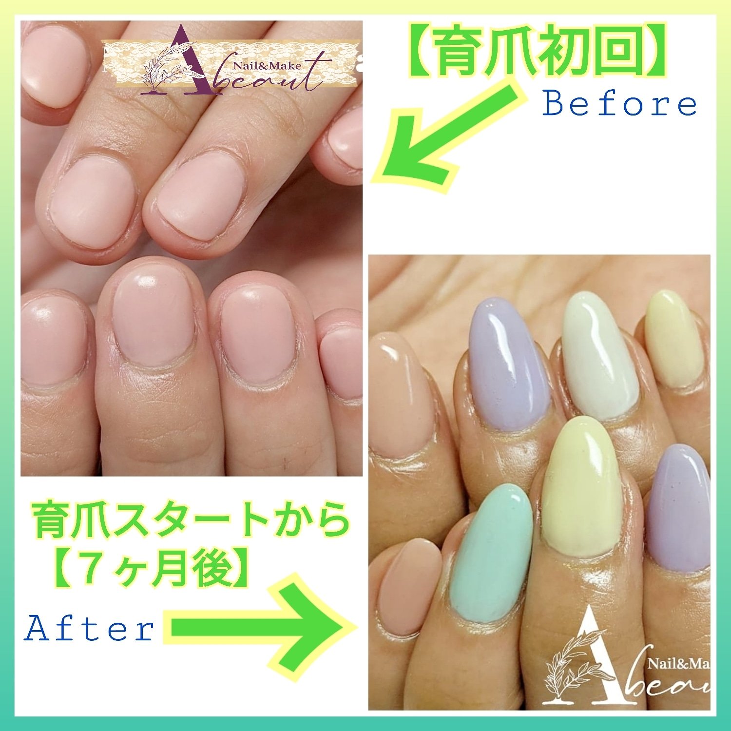富山市 Nail Make Abeaut ネイル メイク アビュート 育爪before After 当サロンに通って下さり 今月で7ヶ月のお客様です 指先の見え方がかなり変わっています 爪を伸ばしただけでは このようにはなりません 育爪を頑張ってくださって