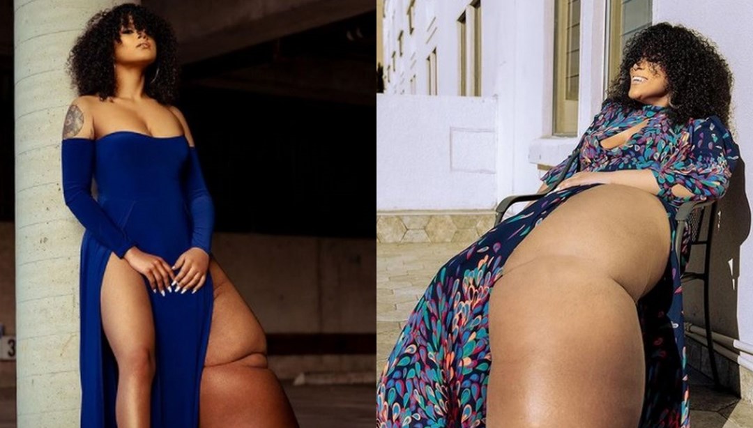 Doğuştan lenfödemili (fil hastalığı) Mahogany Geter acımasız eleştirilere rağmen görünüşüyle barışık yaşıyor: Doğuştan lenfödemi (fil hastalığı) olan Amerikalı Mahogany Geter, biri 45 kilo ağırlığında olan bacağının… dlvr.it/S0H772 #Türkçe #MagazinHaberleri #Magazin