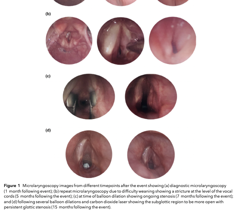 𝘈𝘯𝘢𝘦𝘴𝘵𝘩𝘦𝘴𝘪𝘢 𝘙𝘦𝘱𝘰𝘳𝘵𝘴 tweet media