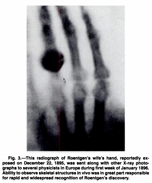 fradafer's tweet photo. Nowadays, having an X-ray is not unusual, but the first person to be scanned did not think so. Mrs Roentgen unintentionally became the subject of an experiment by her unstable husband. She thought it was an image of his own death!

via  DOI: 10.2214/ajr.165.5.7572473 https://t.co/irPXWfyf5Z