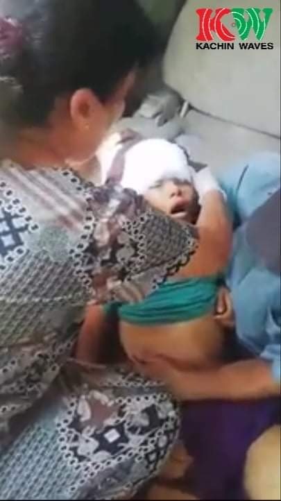 sfys_nn's tweet photo. Tw// blood// death
On May 24 around 1pm, a sixth grader kid who was feeding the chickens near the graveyard in AlinGaung ward, #MoeMauk, #Bhamo, Kachin State,was hit on the head and killed because of the artillery fired by Military terrorists.
#May24Coup
#WhatsHappeningInMyanmar https://t.co/B4caZVTfWG