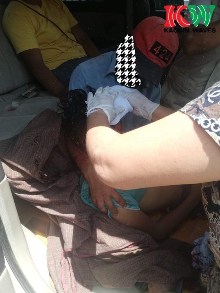 sfys_nn's tweet photo. Tw// blood// death
On May 24 around 1pm, a sixth grader kid who was feeding the chickens near the graveyard in AlinGaung ward, #MoeMauk, #Bhamo, Kachin State,was hit on the head and killed because of the artillery fired by Military terrorists.
#May24Coup
#WhatsHappeningInMyanmar https://t.co/B4caZVTfWG