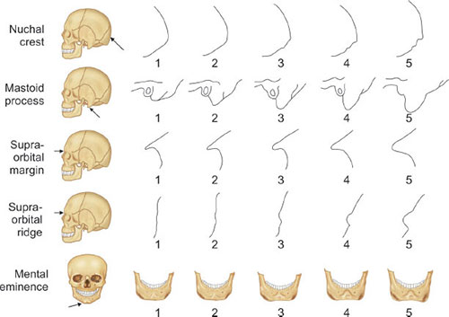bonesforensic's tweet image. sex estimation skull (walker 2008)
